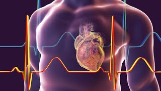 Understanding ECG Changes in Myocardial Infarction [upl. by Julienne855]