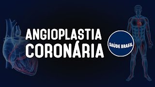 ANGIOPLASTIA CORONÁRIA  SÉRIE SAÚDE BRASIL [upl. by Mera]