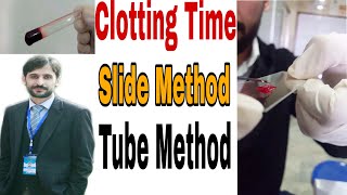 Blood clotting time determination by slide and tube method  CT Test [upl. by Samuele438]