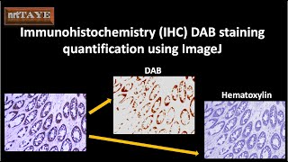 Immunohistochemistry IHC DAB staining quantification using ImageJ [upl. by Rettuc]