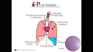 Pathophysiology and Management [upl. by Walsh]