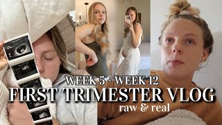 RAW amp REAL FIRST TRIMESTER VLOG weeks 512 morning sickness remedies tips processing pregnancy [upl. by Bubalo144]