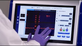 Azure Western Blot Imaging Systems [upl. by Onidranreb835]