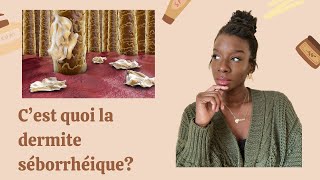 Tout savoir sur la dermite séborrhéique Les causes comment traiter [upl. by Oek843]