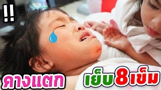 หนูยิ้มคางแตก ต้องเย็บ 8 เข็ม [upl. by Apostles]