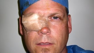 Removal of eye patch and first reaction after cataract surgery after being 70 blind [upl. by Watt]