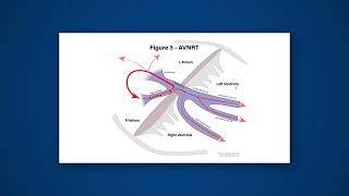 OptimseCardio ST4 Cardiology InterviewTaster [upl. by Debera305]