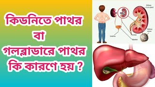 কিডনিতে পাথর বা গলব্লাডারে পাথর কি কারনে হয়   What causes kidney stones and gallbladder stones [upl. by Anna-Diana]