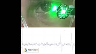 RoboticsBD Eye Blink Detection Analog Sensor with Goggles High Quality [upl. by Nnaeiluj970]