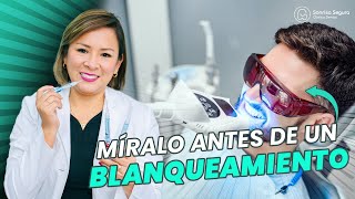 Blanqueamiento Dental Lo Que Debes Considerar Antes de Empezar [upl. by Maison]