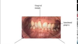 Week 1 Perio Ch 14 Part 1 The Periodontium [upl. by Anailuig]