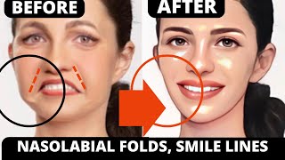 🛑 ANTIAGING FACE LIFT EXERCISES FOR JOWLS LAUGH LINES EYE BAGS DOUBLE CHIN SAGGY SKIN FOREHEAD [upl. by Chemarin]