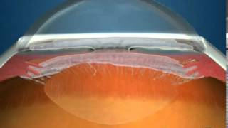 How Fluid Circulates in the Eye [upl. by Ronica]