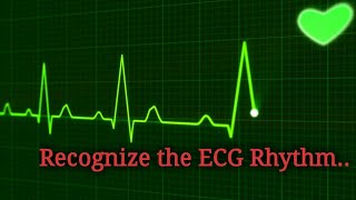 Identify the ECG Rhythm  EKG Interpretation [upl. by Akenna643]