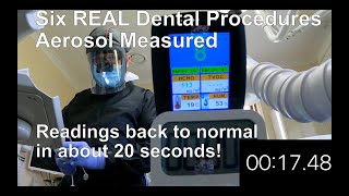 Dental aerosol with full air filtration systems measured in real AGP procedures [upl. by Stephanus]