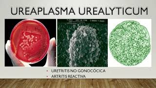 Ureaplasma Enfermedades Transmisibles [upl. by Ahsenit985]