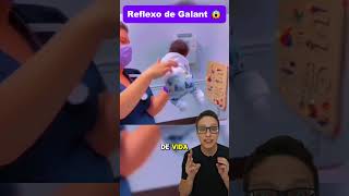 Reflexo de Galant😱👶 medicina medico pediatria enfermagem enfermeira pediatriaonline pediatra [upl. by Janey]