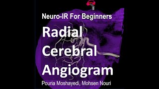 Radial Cerebral Angiogram A Video Tutorial [upl. by Ode]