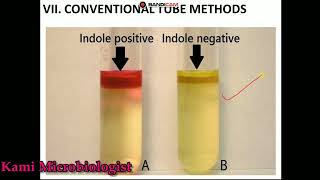 Indole test biochemical test lecture 7 [upl. by Odlaner115]