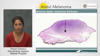 Melanoma Pathology Report [upl. by Sivraj667]