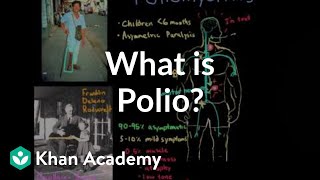 What is polio  Infectious diseases  NCLEXRN  Khan Academy [upl. by Ayortal]