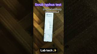 Scrub typhus test lab labtechnician [upl. by Inaliak]