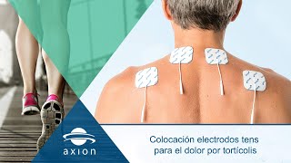 Colocación electrodos TENS para dolor de tortícolis  Electroestimulación TENS para terapia de dolor [upl. by Fortunio951]