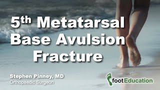 5th Metatarsal Base Avulsion Fracture [upl. by Trofmoc217]