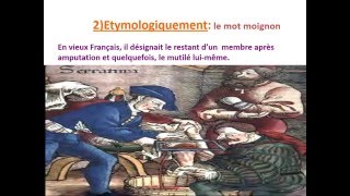 traumatologie AMPUTATIONS DE MEMBRE INFERIEUR [upl. by Aicram140]