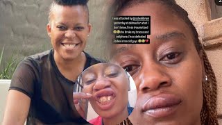 Zodwa wa bantu does the unthinkable after being moered by her Ben10 [upl. by Tades]