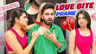 Hickey Prank Gone Wrong 😱 Ayushyadav [upl. by Tryck]