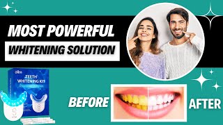 Ollm Teeth Whitening Kit  Things You Must Know Before Buying [upl. by Haberman47]