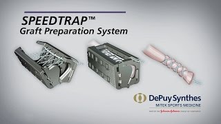 SPEEDTRAP™ Graft Preparation System [upl. by Shep]