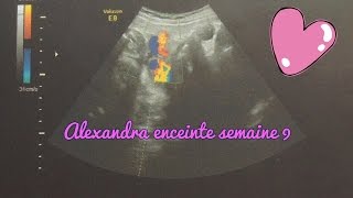 Alexandra enceinte  semaine 9 [upl. by Adnam176]