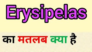 Erysipelas meaning in hindi  erysipelas ka matlab kya hota hai  word meaning english to hindi [upl. by Gilliam]