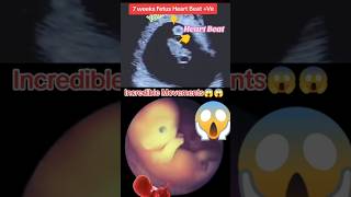 7 weeks fetus heart beat Ve pregnancy ultrasound🥰🥰viralvideo trending [upl. by Baal]