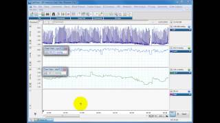 Calculating systolic diastolic and MAP from blood pressure traces [upl. by Aitropal]