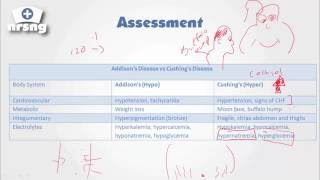 Cushings Syndrome NCLEX® Review  NRSNGacademycom [upl. by Ehlke331]