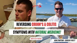 Reversing Crohns amp Colitis Symptoms with Natural Medicine [upl. by Alle]