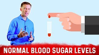 What is Normal Fasting Blood Sugar Levels on Intermittent Fasting – DrBerg [upl. by Calore]