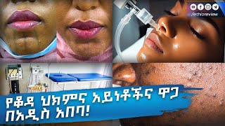 የቆዳ ህክምና አይነቶችና ዋጋ በአዲስ አበባ Dermatology Clinic in Addis Ababa Ethiopia [upl. by Dranik206]