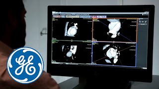 Post Processing with GE Advanced Workstation  GE Healthcare [upl. by Eerdua]