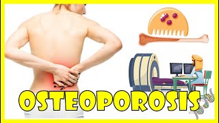 Osteoporosis  Causes Pathogenesis Signs amp Symptoms And Diagnosis [upl. by Gasser]