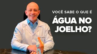 VOCÊ SABE O QUE É quotÁGUA NO JOELHOquot DrANDRÉ KRUEL [upl. by Angelica]