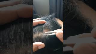 MOST satisfying white hair removal relaxing stressremoval hairremoval [upl. by Nicholl]