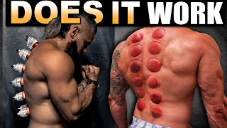 Cupping Therapy for Cellulite  How to Get Rid of Cellulite with Cupping [upl. by Byran]