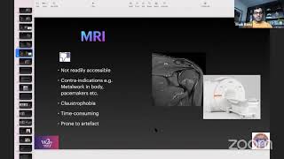 MSK Radiology for Upper Limb Conditions [upl. by Atal]