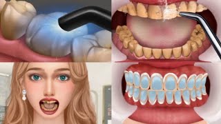 ASMR Mouth Cleaning  Get rid of bad breath  tonsil stones removal salivary glands cleaning [upl. by Allys]