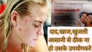 Gamaderm p soapayurvedicarmedicalgyan9935 [upl. by Atinahc]