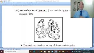 Thyroid disorders in Arabic 8 Thyrotoxicosis  part 1    by Dr Wahdan [upl. by Atekram224]